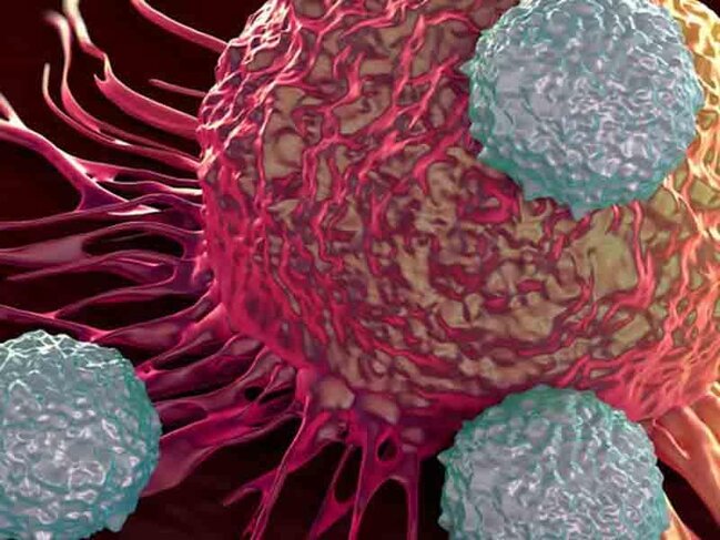 Xərçəng riskini azaldan sadə vərdişlər - Həkimdən vacib açıqlama