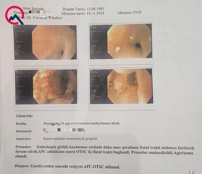 Bir ildə 7 dəfə əməliyyat olunduğunu deyən xəstə şikayətçidir - Həkimdən açıqlama