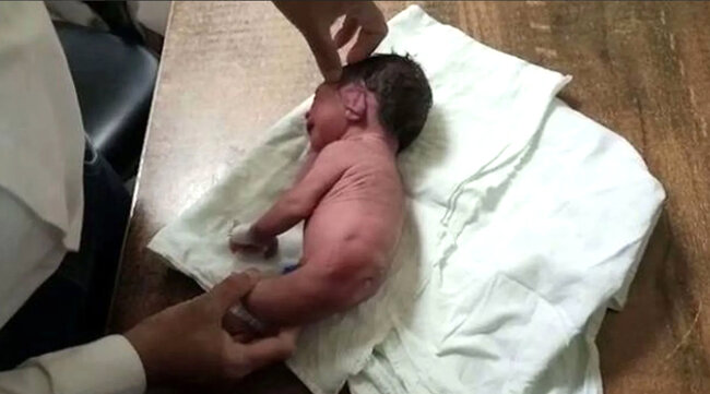 Yeni doğulan körpənin bədən quruluşu görənləri şoka saldı: Beldən aşağı... - FOTO