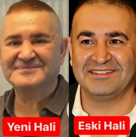 54 yaşlı aktyor tanınmaz hala düşdü