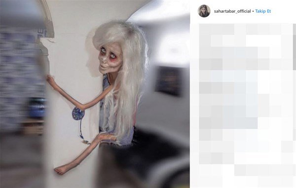 Coliye bənzəmək üçün onlarla əməliyyat etdirən fenomenin 10 il öncəki ŞOK HALI - FOTOLAR