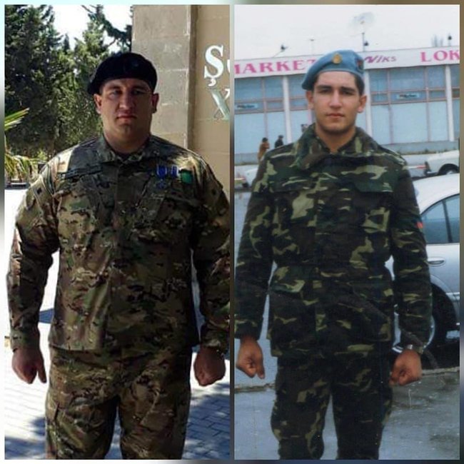 Cəbhədə snayperlə gicgahından vurulan İlham Zəkiyevin xəstəxanadan FOTOSU