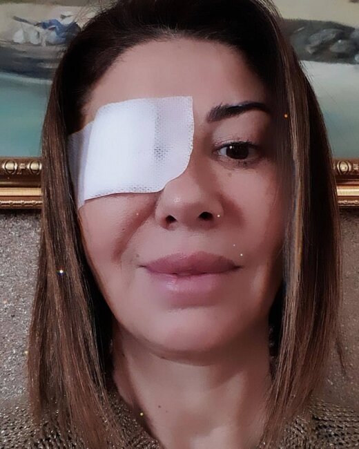 Zülfiyyənin başına iş gəldi - FOTO