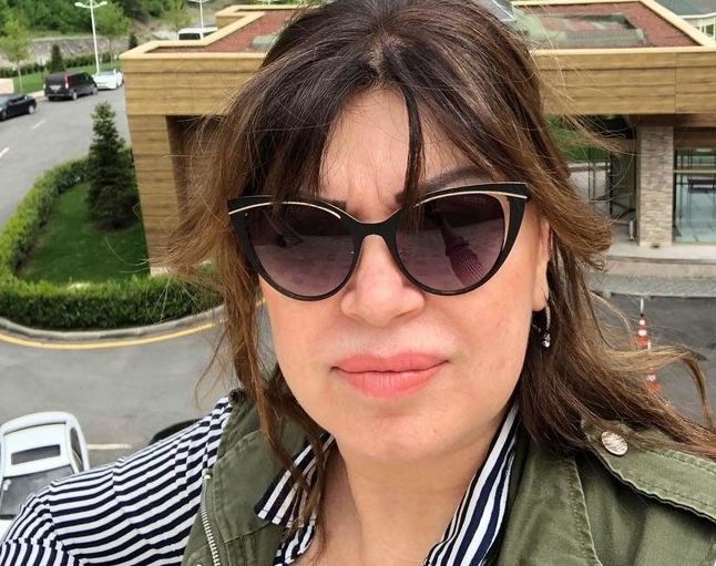 Gözü böyüyən əməkdar artistin SON HALI - FOTOLAR